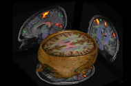 Mapping the Brain